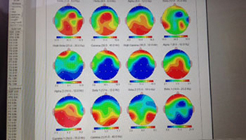 brain map